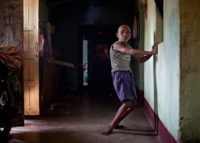 Ten-year-old Sanjay Gope of Bango village near Jadugora moved normally as a toddler until seizures began to wring the life from his arms and legs. When there is no family member around to assist him in walking, he is "forced to crawl around the ground like a snake," according to his grandfather. (Redux for Bloomberg.com)