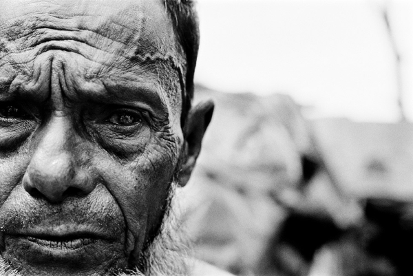 Blind in one eye after being beaten in the head during forced labor, this man fled from Myanmar in the mid-1990s and is one of an estimated 300,000 undocumented Rohingya now living in the southern part of neighboring Bangladesh. (Greg Constantine)